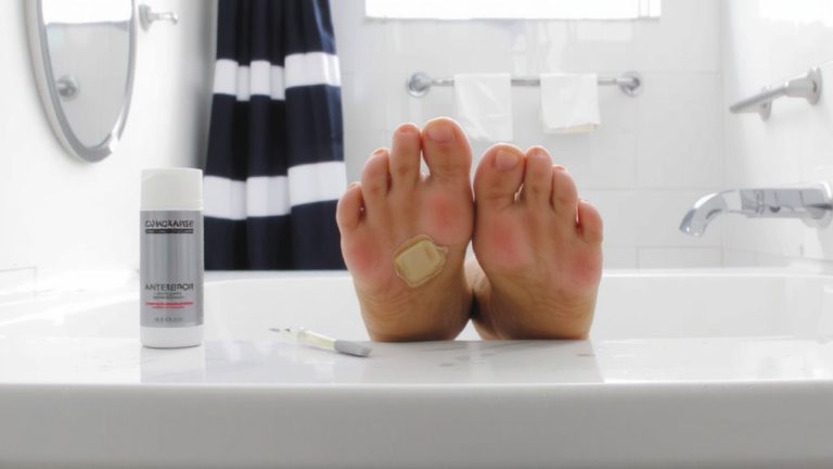 antiperspirant toenail treatments hyperhidrosis