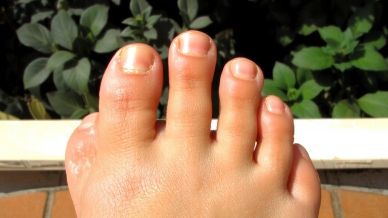 best toe nail colors