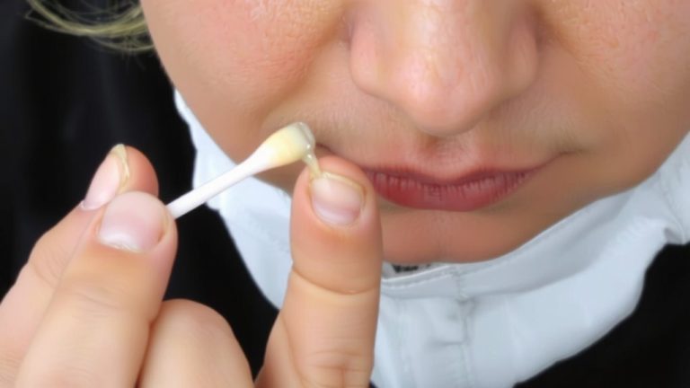 chronic paronychia prescription treatments