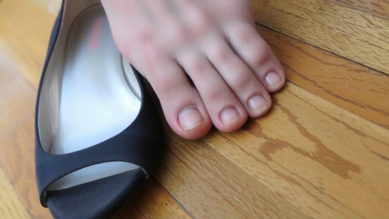 genetic or shoe induced toenail curling