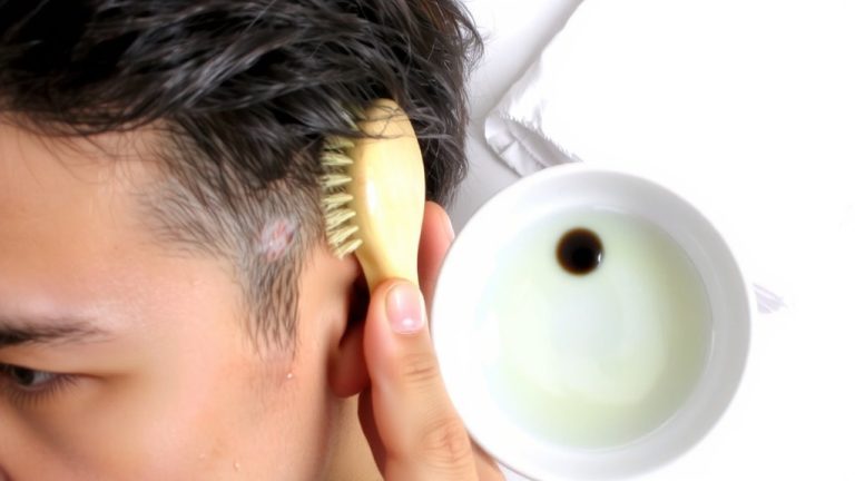 gentle exfoliation for adult cradle cap