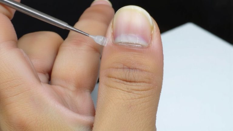 medical glue reattachment procedure