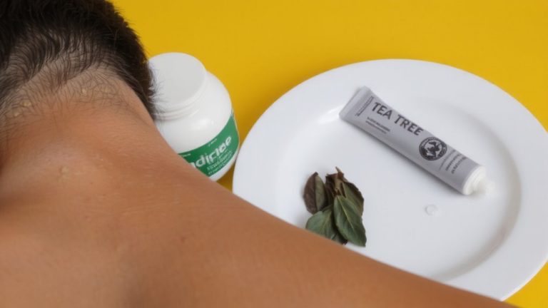 over the counter seborrheic dermatitis treatments