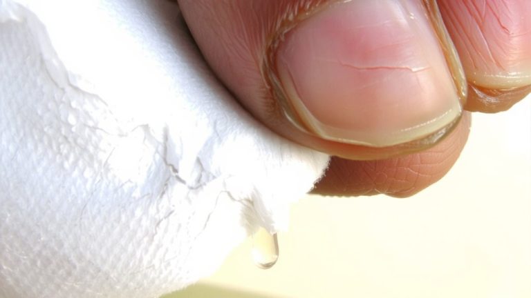revive dry winter nails